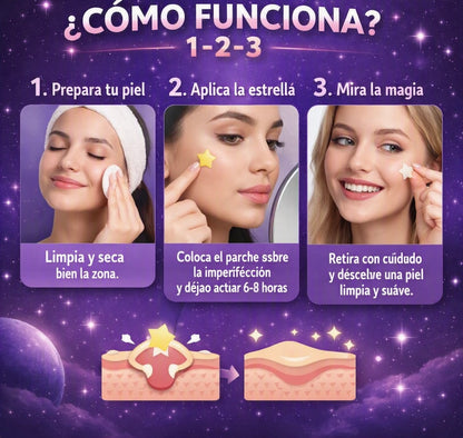StarBeauty™ – Pack Gigante de 240 Parches Hidrocoloides